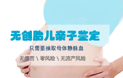 成都怀孕十八周需要怎么办理血缘检测,成都产前亲子鉴定收费标准 成都怀孕十八周需要怎么办理血缘检测,成都产前亲子鉴定收费标准